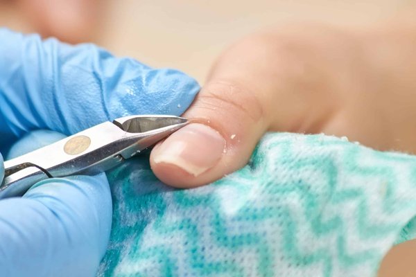 Les meilleures méthodes pour bien blanchir vos ongles